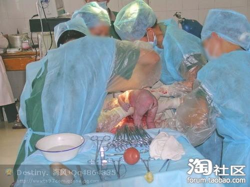 医院借卵代孕男孩过程